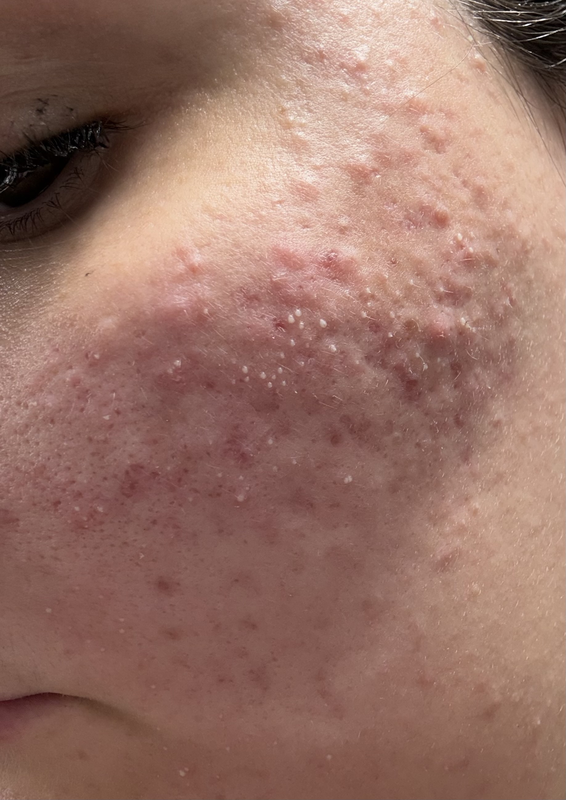 medicube PDRN Pink Peptide Ampoule review image