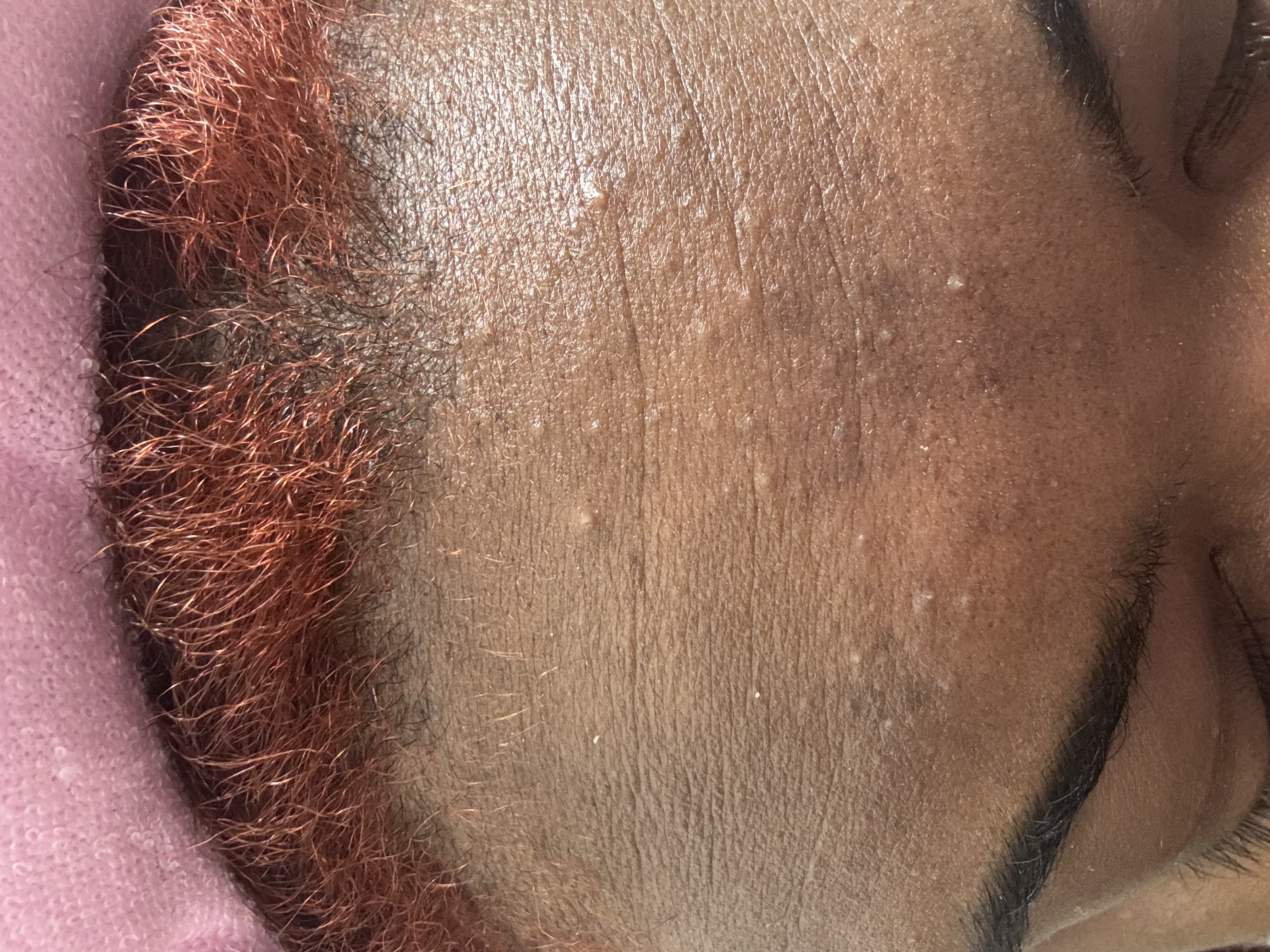 Expert Madecar 活力再生 PDRN 面霜的真实用户使用照片