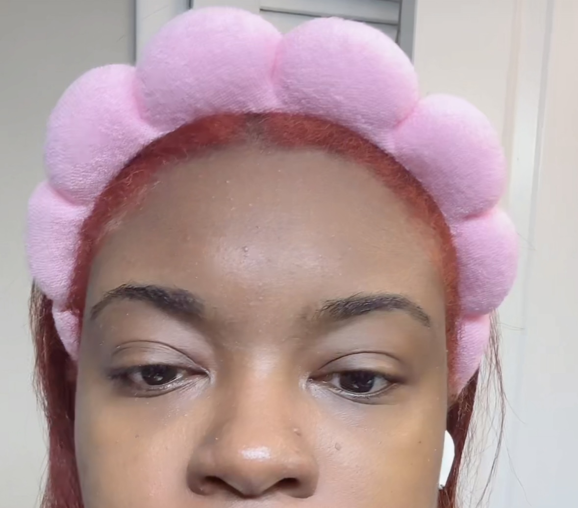 Expert Madecar 活力再生 PDRN 面霜的真实用户使用照片